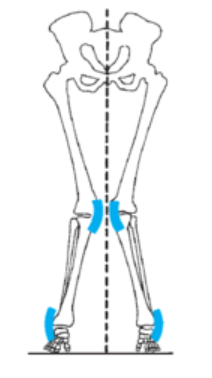 <p><span>In the accompanying figure, the knee alignment is considered to be excessive _____ and the ankle alignment is excessive _____.</span></p>
