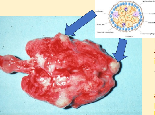 <p>Based on the diagram and appearance, what are the lung lesions indicated in the photo formed by?</p>