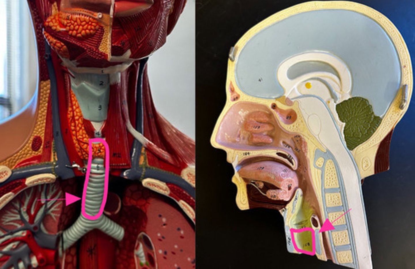 <p>anterior to the esophagus</p>