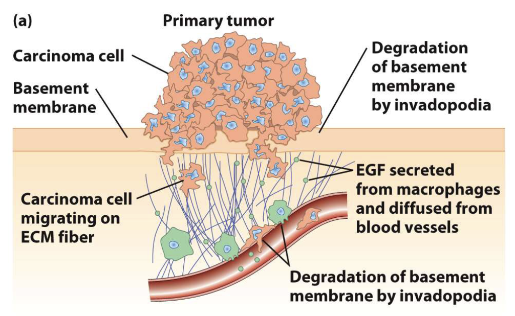 <ul><li><p>Use <strong>invadopodia</strong> to breach basement membranes</p></li><li><p>Migrate to distant body sites</p></li><li><p>Example: breast carcinoma cells</p></li></ul><p></p>