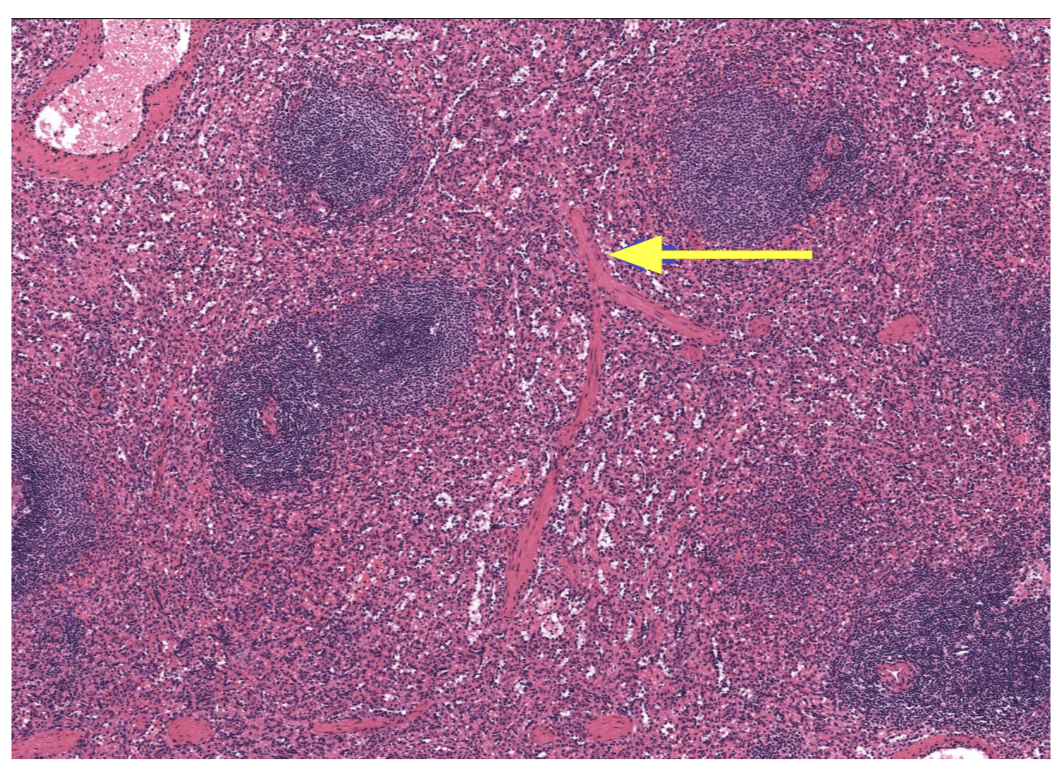 <p>The <strong>Thymus</strong></p><ul><li><p>Note: image shows Trabeculae</p></li></ul><p></p>