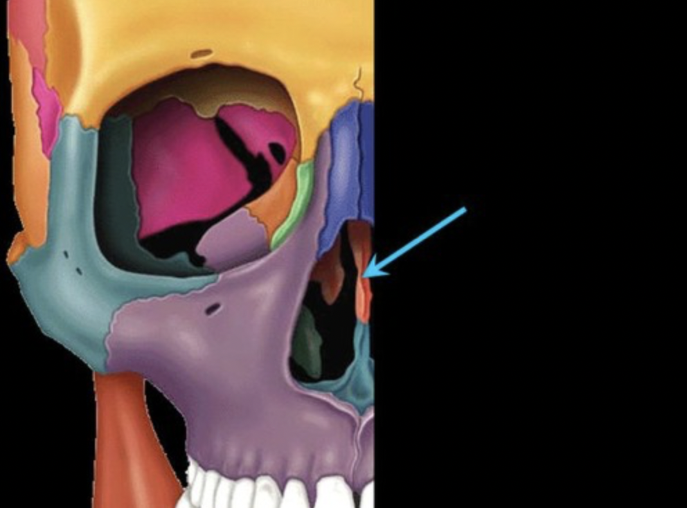 <p>superior portion of the bony nasal septum</p>