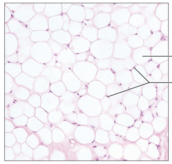 <p>What is this tissue, and where is it found?</p>
