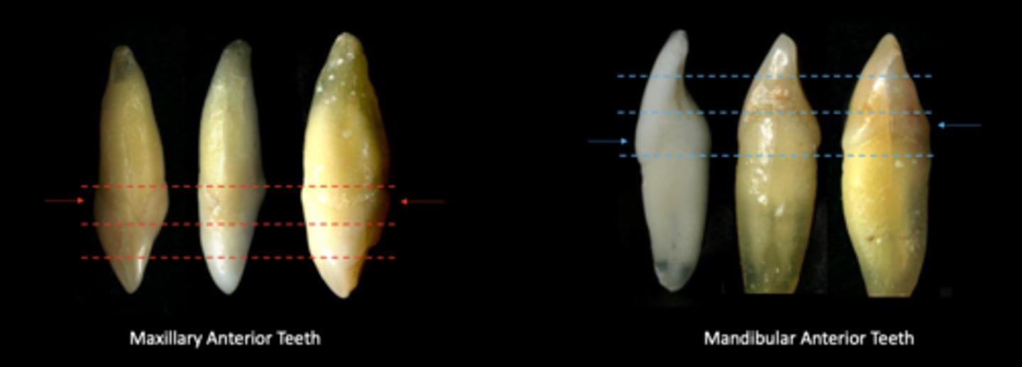 <p>The facial and lingual HOC of all permanent anterior teeth is in the...</p>