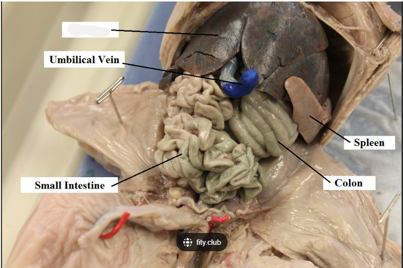 <p>What is marked out on the fetal pig? </p>