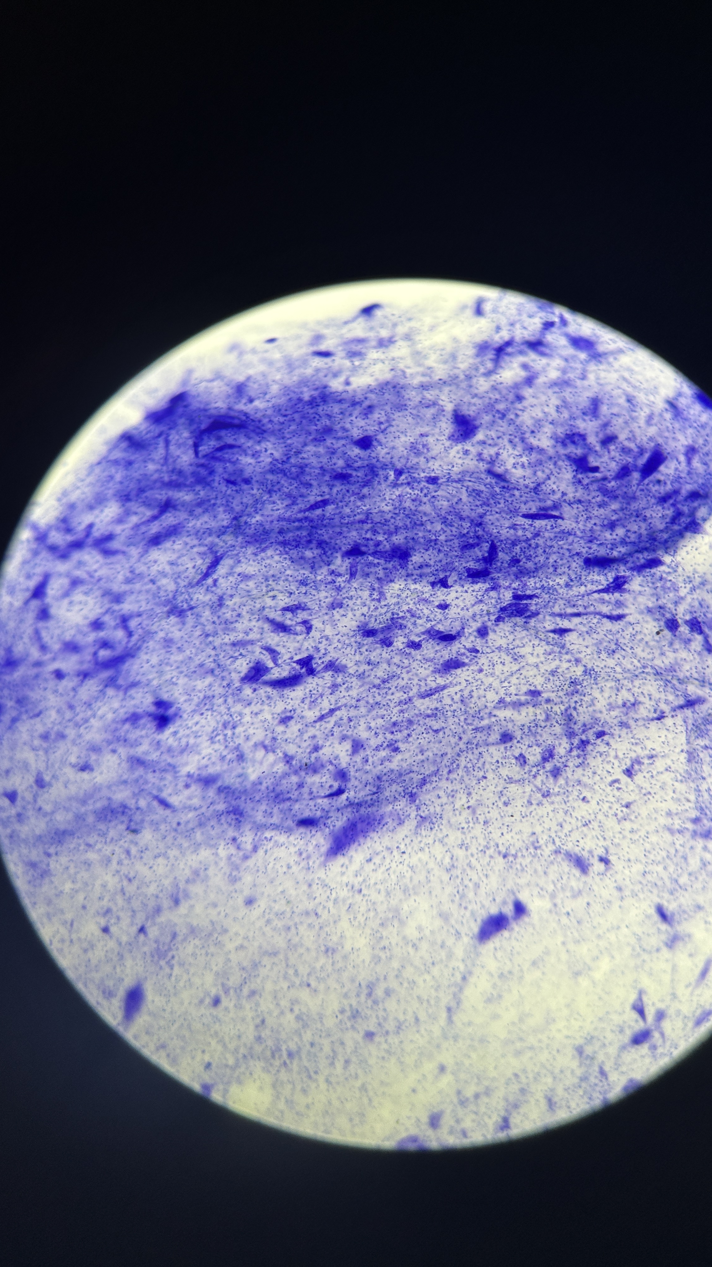 <p>What is the magnification level of the Nervous Tissue?</p>