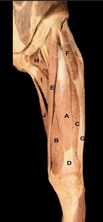 <p>Identify the muscles on this<strong> Anterior View</strong>&nbsp;of the thigh</p>