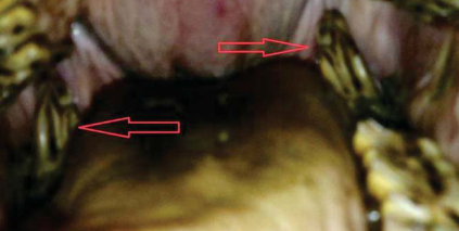 <p>What dental abnormality is this?</p>