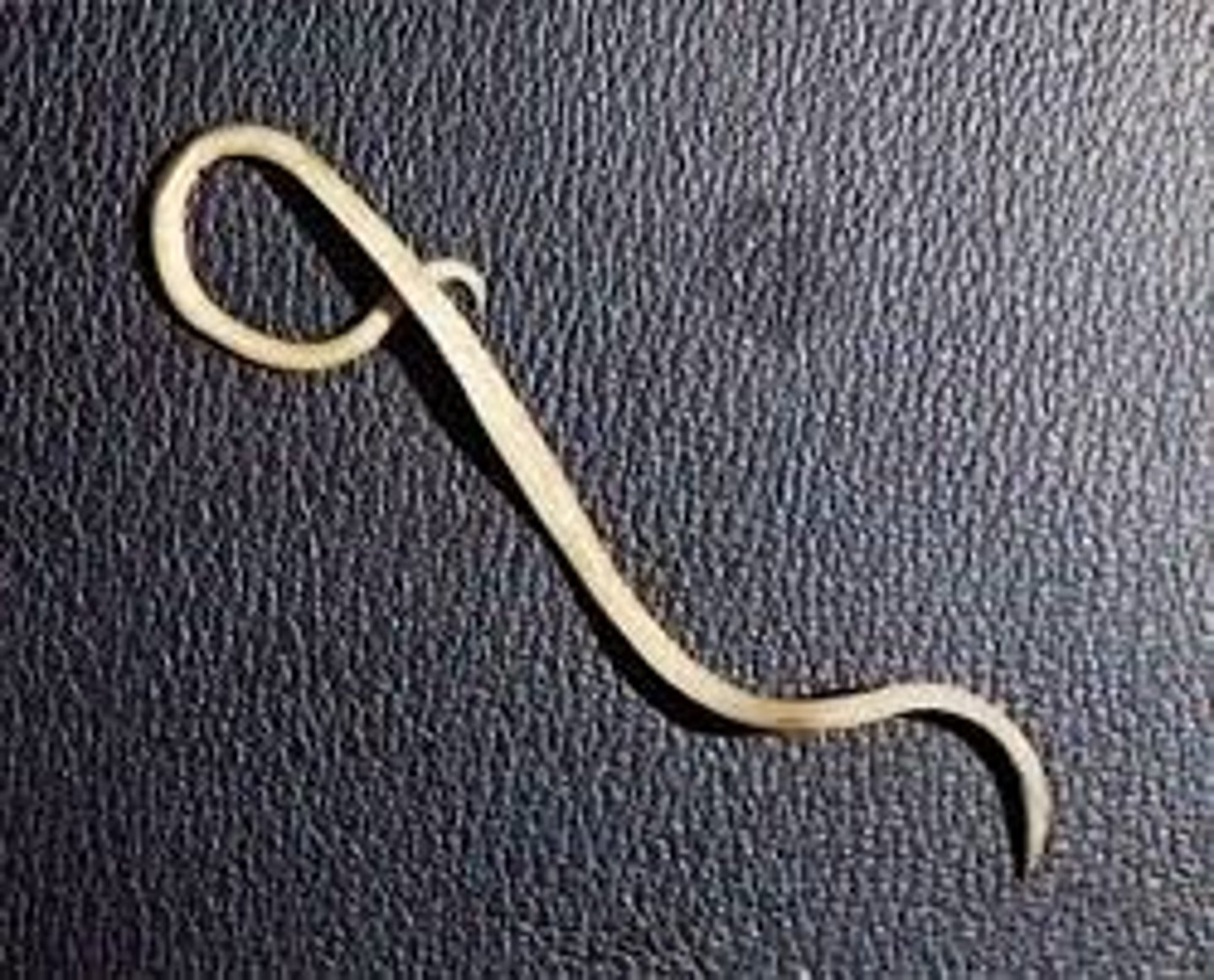 <p>- Non-segmented nematodes</p><p>- Mostly colorless worms that infect humans, animals, and plants</p><p>- Parasitic worms</p><p>- Common in rural areas of Appalachia and Southeastern US</p>