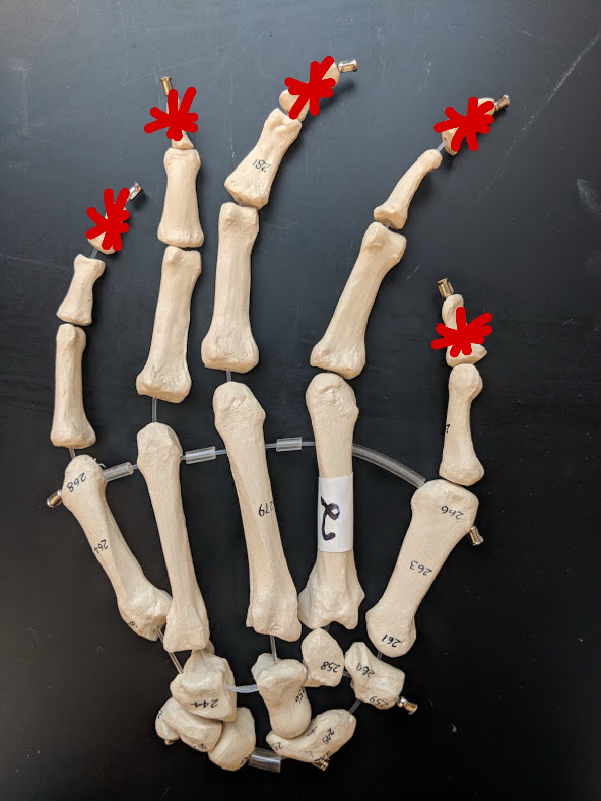 <p>Name these bones</p>