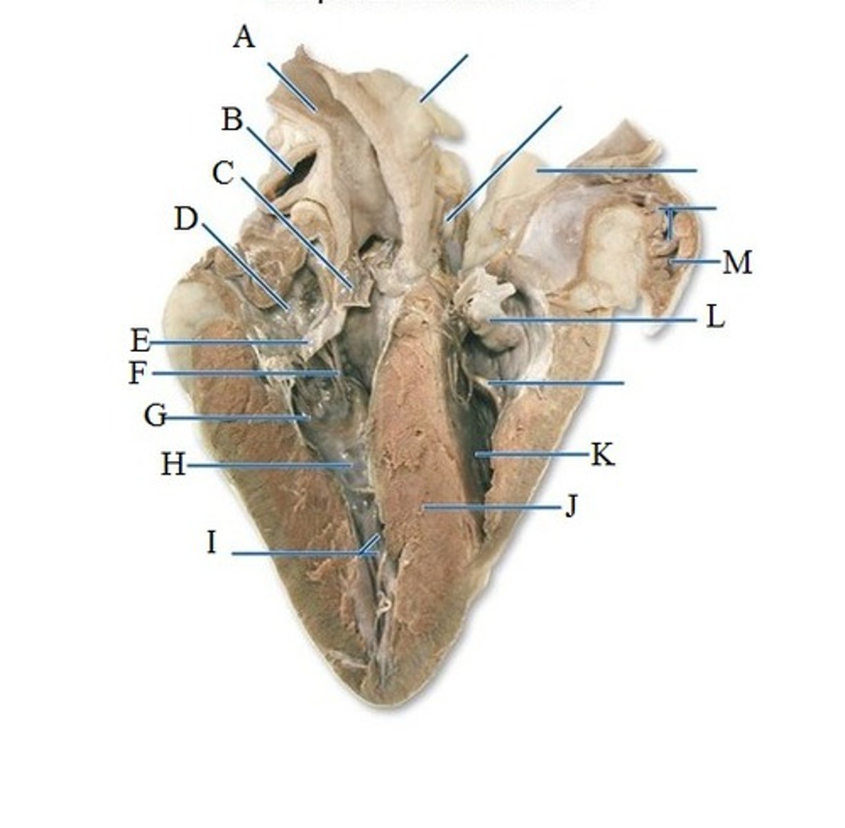 <p>A</p>