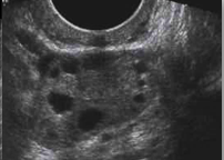 <p>What structure is this, what approach is it scanned through, and what in view?</p>