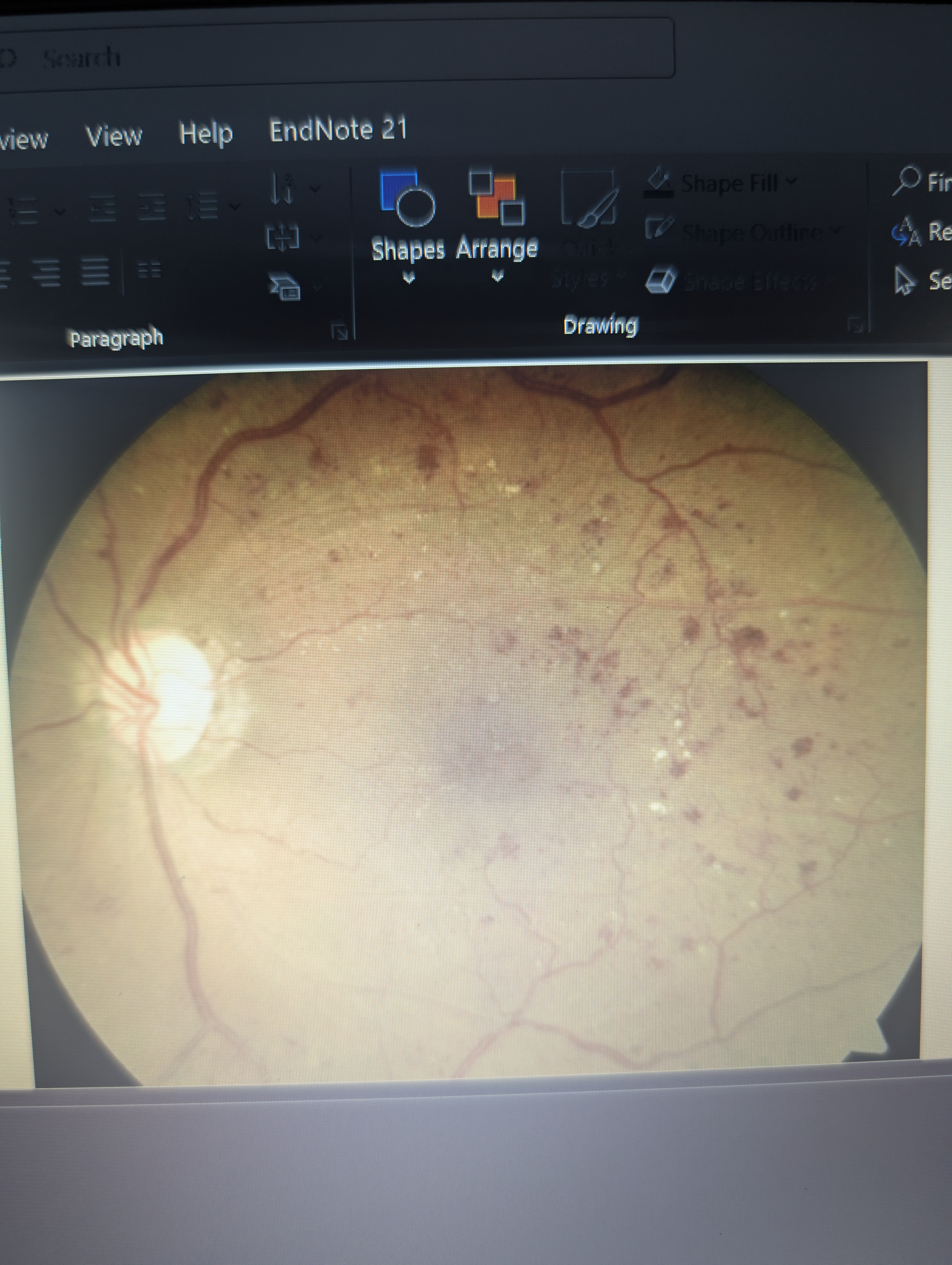 <p>What is this pathology?</p>