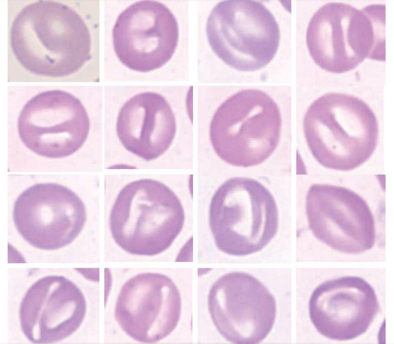 <p>what is a knizocyte?</p>