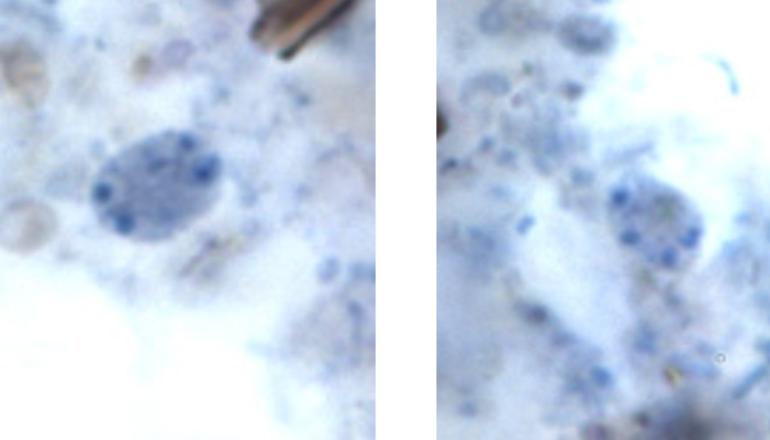 <p>Identify the organism. Give genus and species.</p>