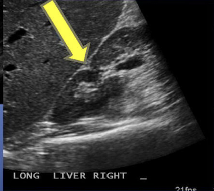 <p>What is the arrow pointing to:</p>