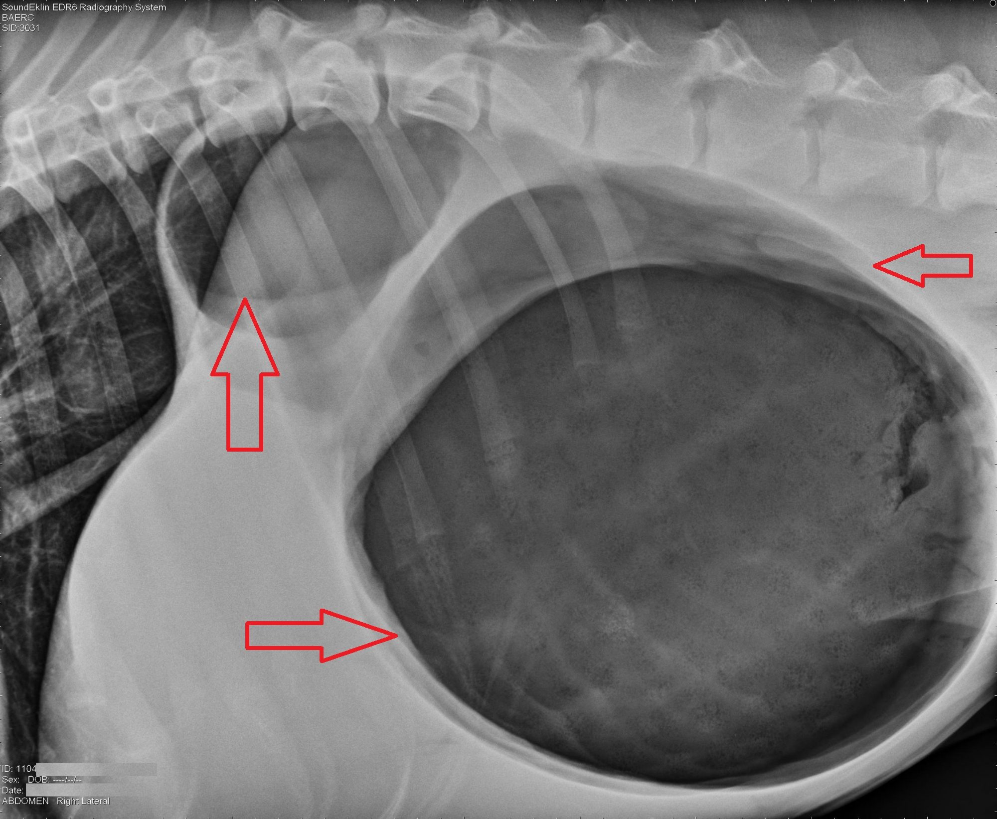 X-ray (showing a "boxing glove" or "two separate gas-filled stomachs" appearance).