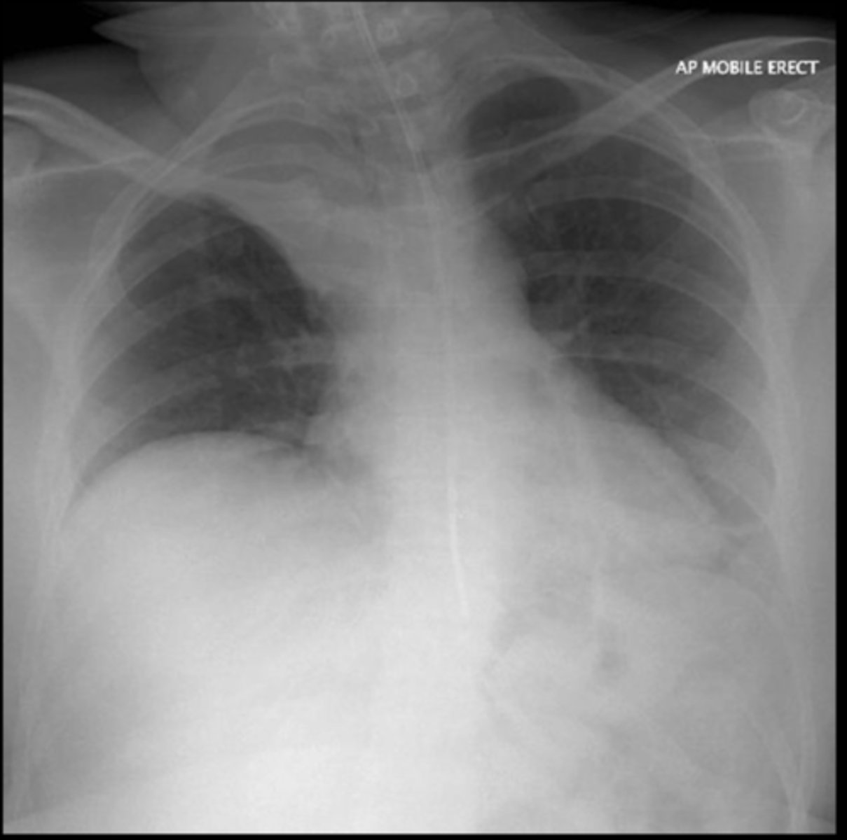 <p>What is your diagnosis? Why?</p>
