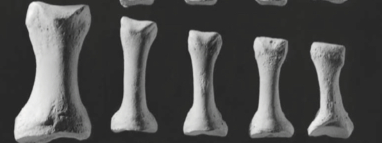 <p>Toe bones that articulate with the metatarsals </p>