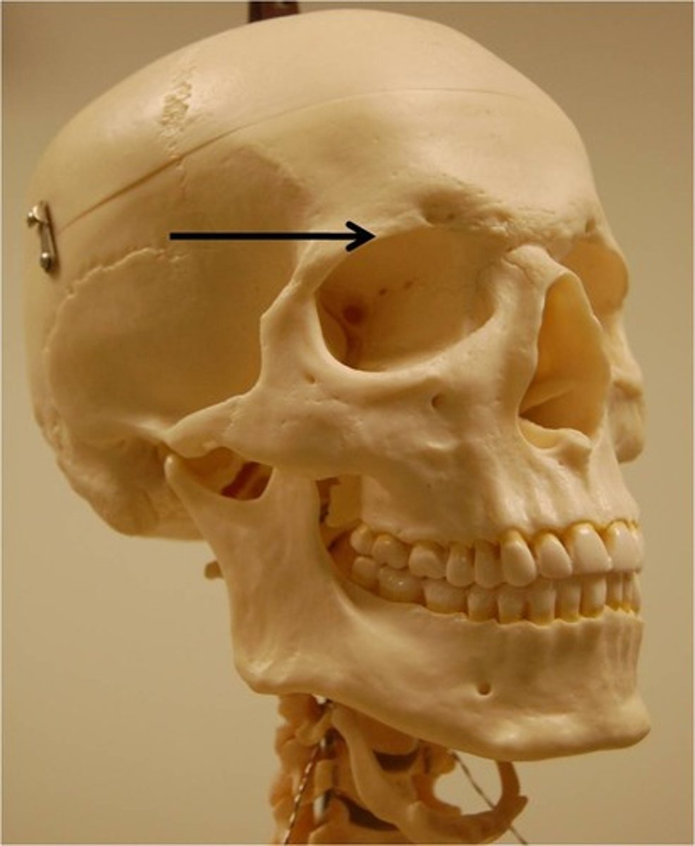 <p>thick margin of the eye socket that lies beneath the eyebrows</p>
