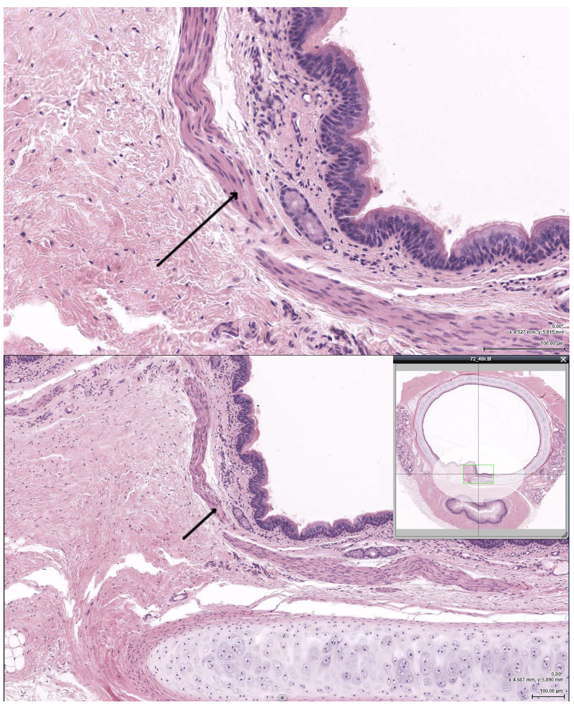 <p><span><span>The structure indicated by the arrow is most likely which of the following?</span></span></p>