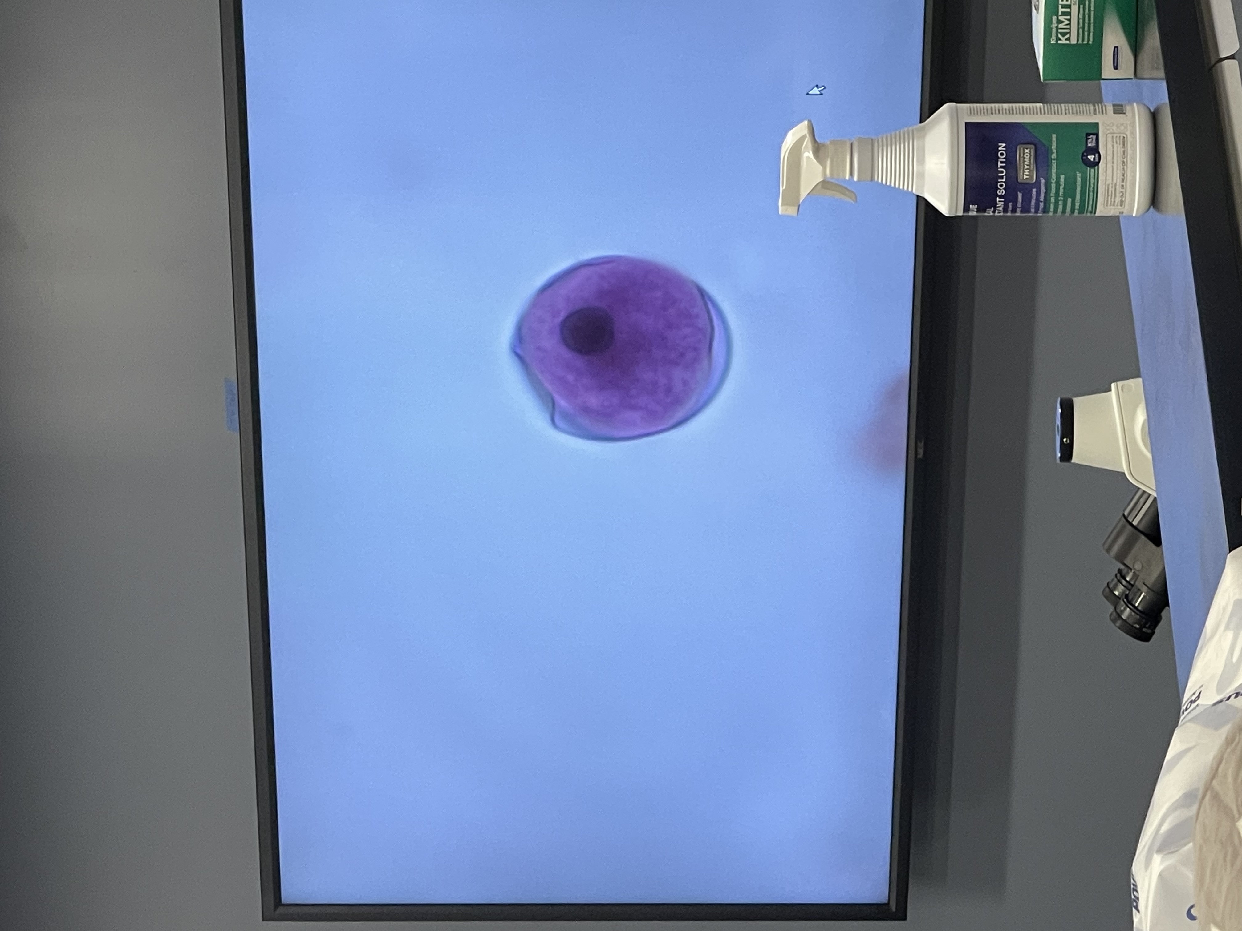 <ul><li><p>causes balantidiasis </p></li><li><p>acquired by human through pig feces </p></li><li><p>fecal, oral route </p></li><li><p>asymptomatic; diarrhea </p></li><li><p>ciliate protist </p></li></ul>