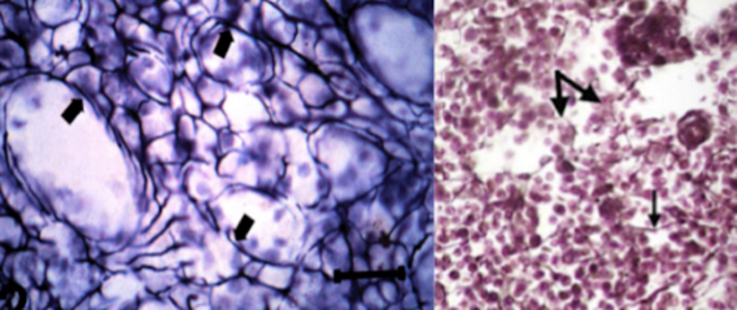 <p>What tissue type are these?</p>