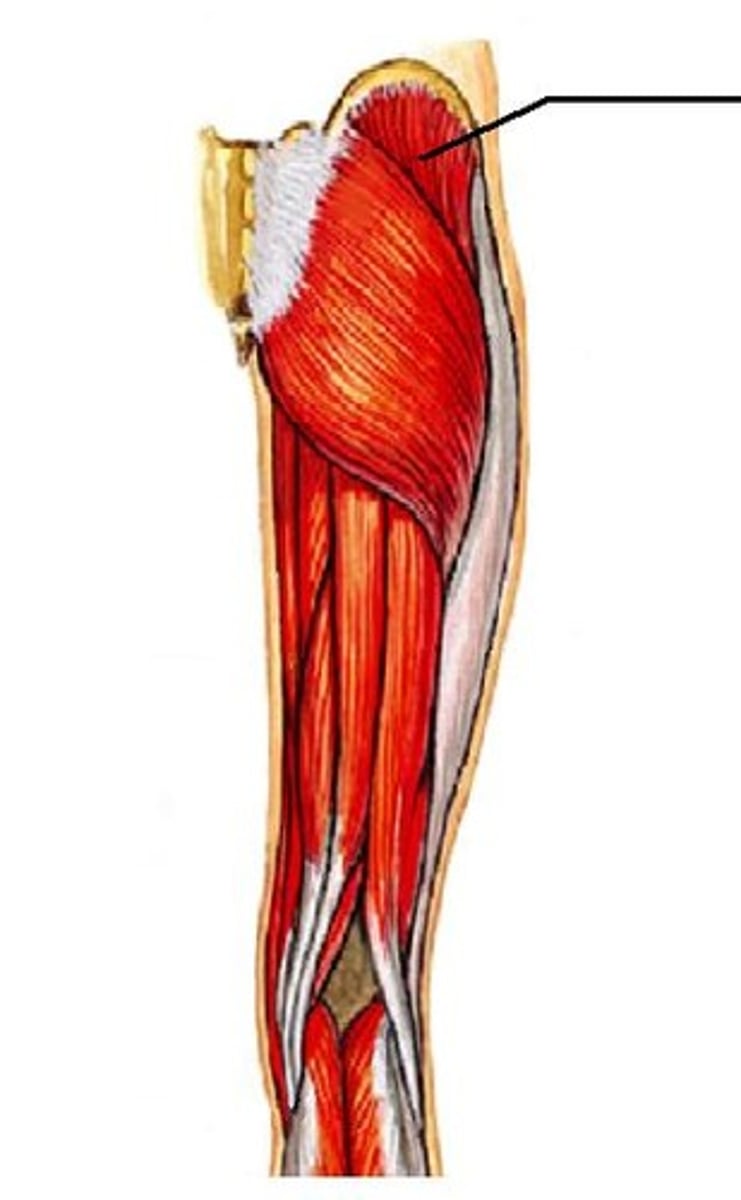 <p>Proximal attachment: Iliac crest</p><p>Distal attachment: Femur (greater trochanter)</p><p>Comments, Applications and Relationships: Site for intramuscular gluteal injections</p><p>Action: Abductor and medial rotator of the thigh at the hip</p>