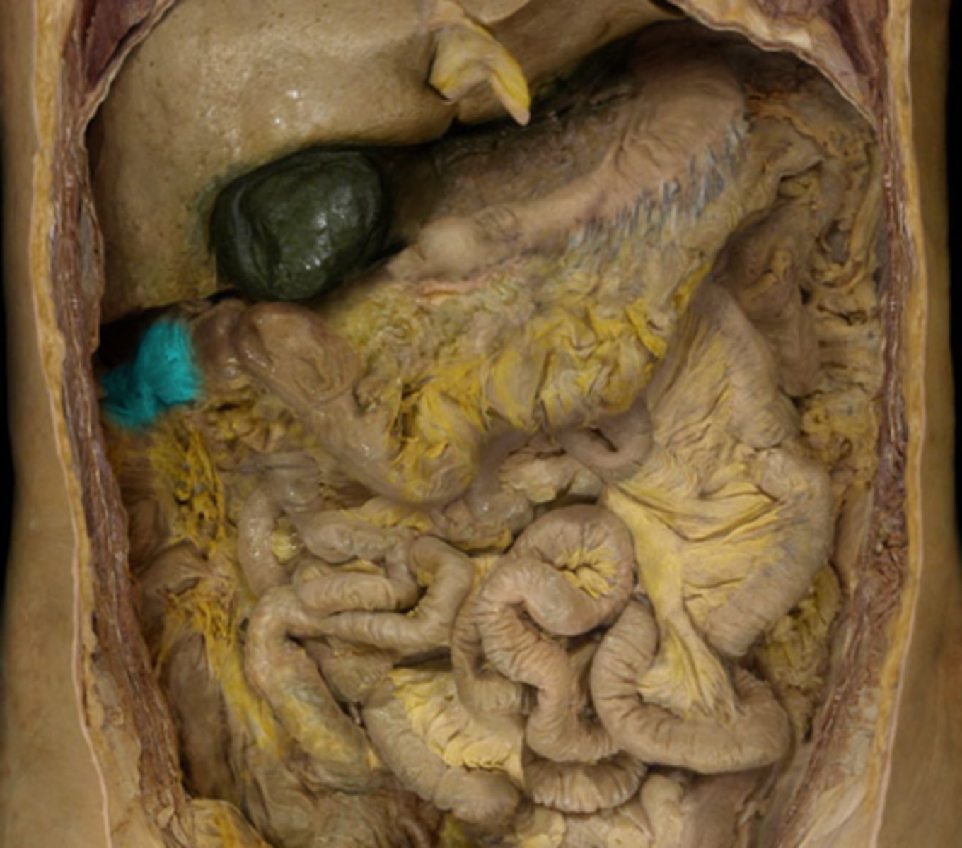 <p>The bend in the colon between the ascending and transverse colon.</p>