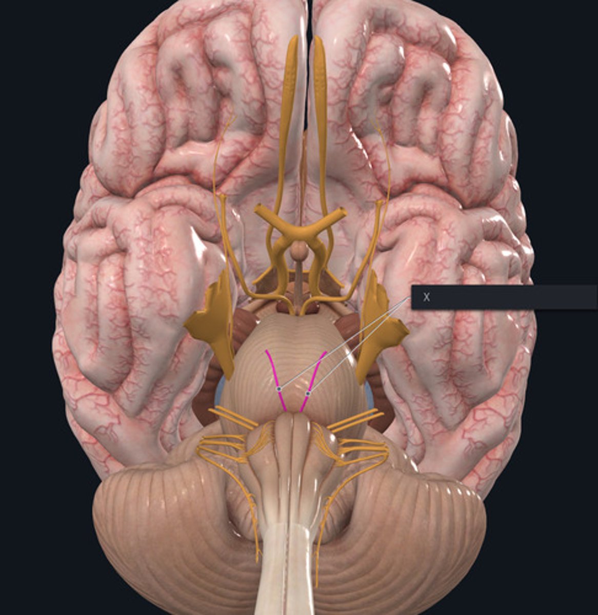 <p>Name the Nerve highlighted purple and indicated by the X.</p>