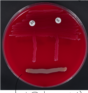 <ul><li><p>gamma-hemolysis (red)</p></li><li><p>group D strep</p></li><li><p>bile esculin positive</p></li></ul><p></p>