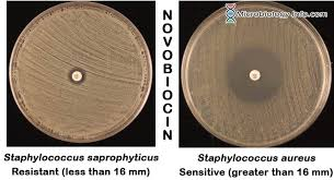 <p>Novobiocin Sensitivity Test </p>