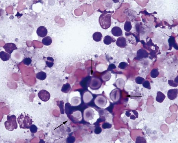 term image