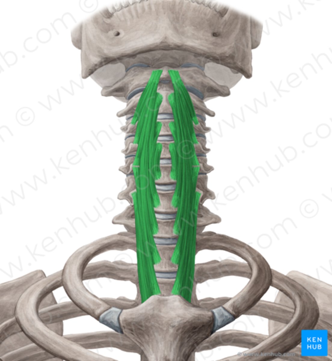 <p>Welke spier is dit?</p>