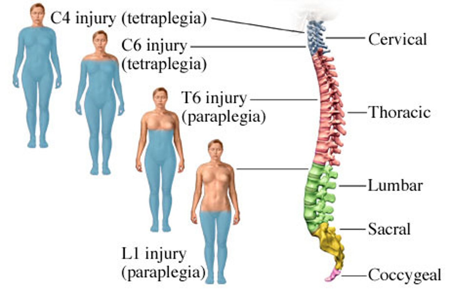 <p>Which of the following pathologies is not a condition of the peripheral nervous system?</p>