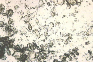 <p>Artifact</p><ul><li><p>flat sheets</p></li><li><p>can be confused with cholesterol</p></li></ul><p></p>