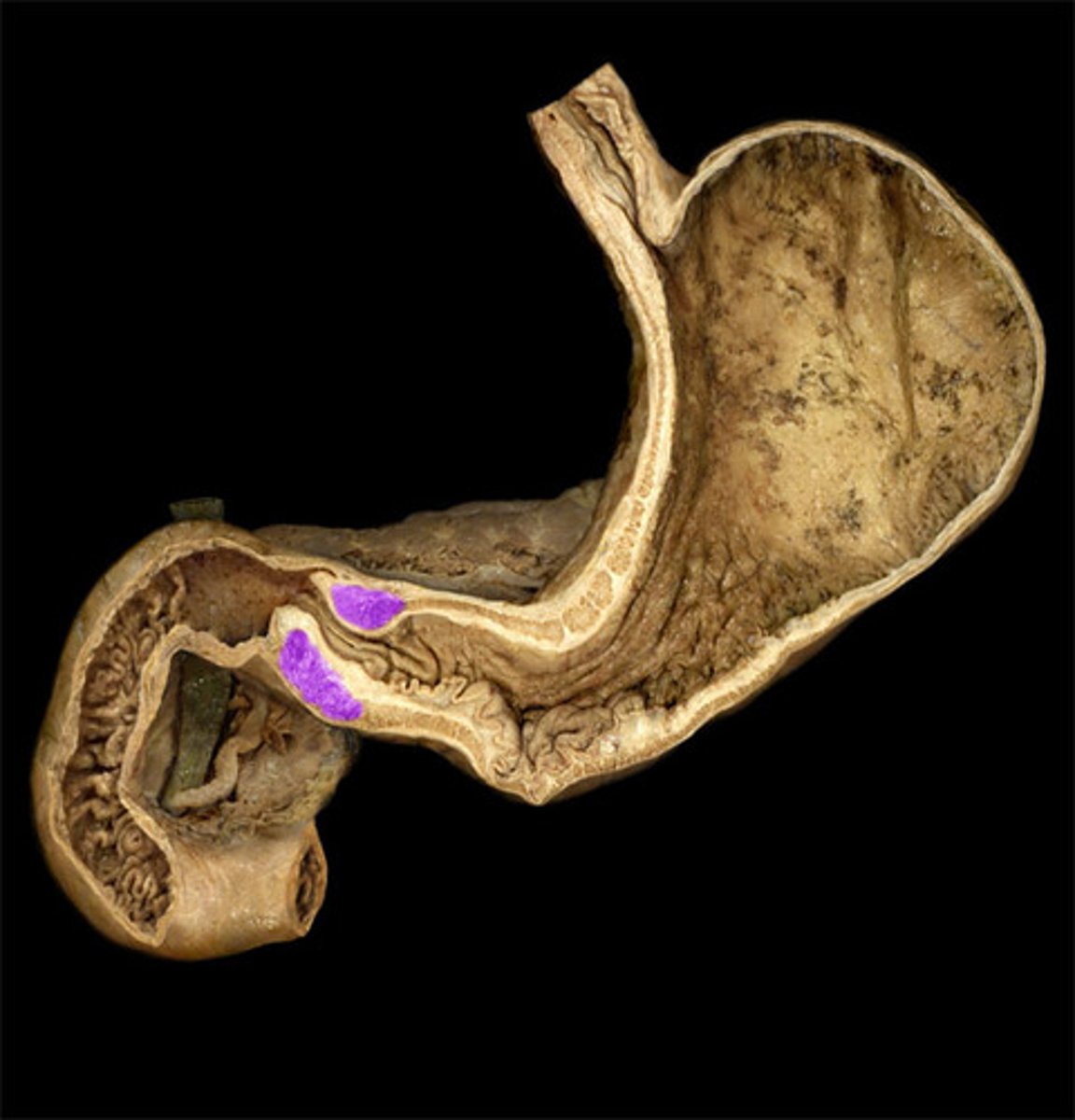 <p>what is highlighted in this image?</p>