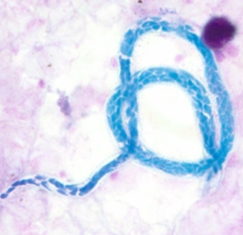 term image