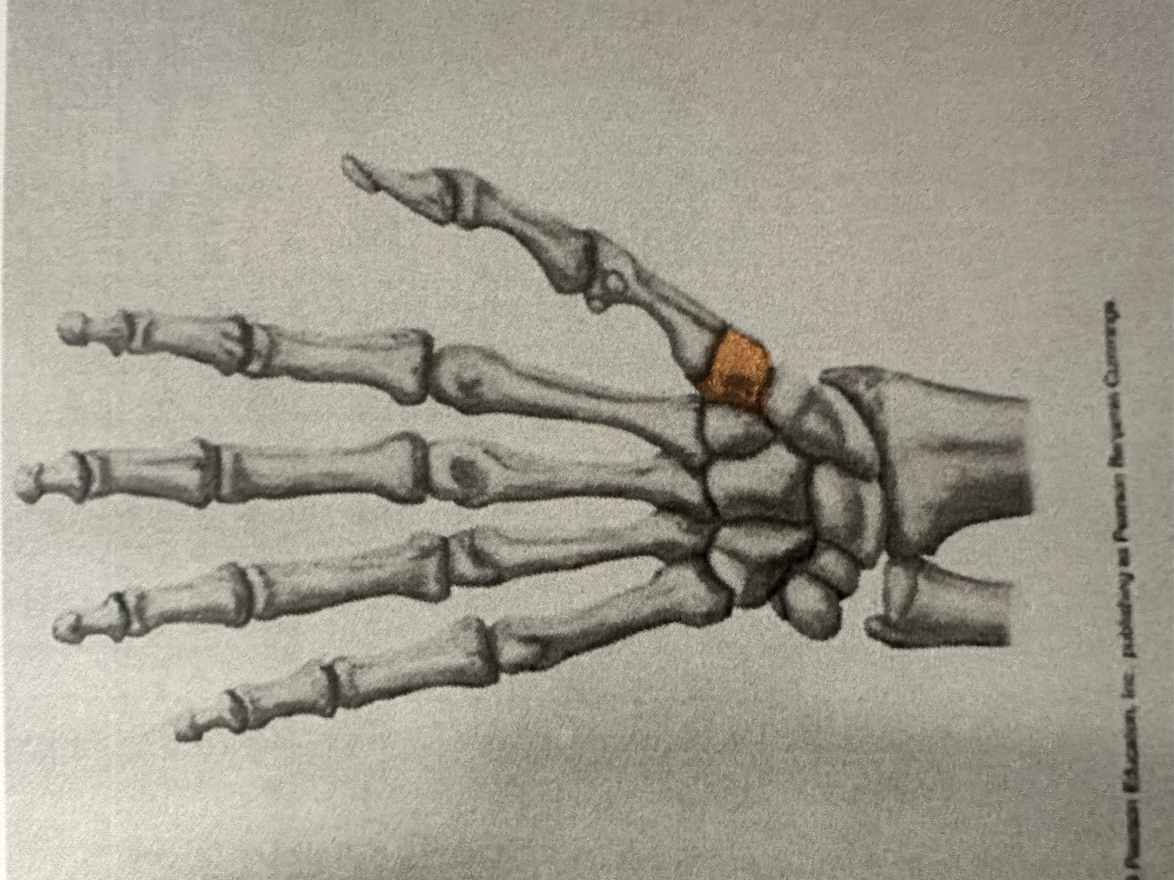 <p>Distal Carpal Bone</p><p>( Here Comes The Thumb)</p>