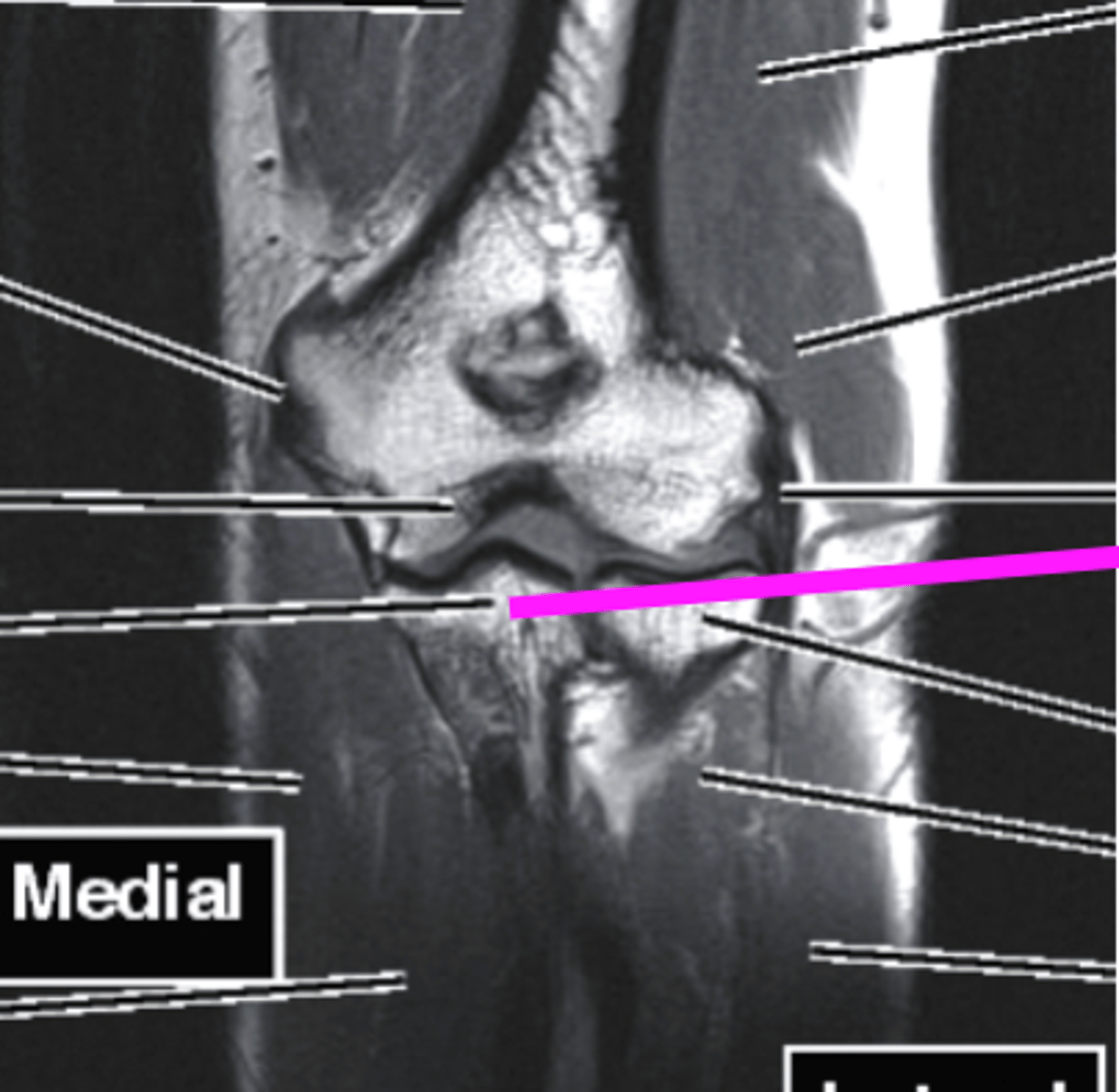 <p>what does this pink line point to?</p>