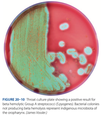 <p>Small translucent colonies surrounded by clear zone of β hemolysis.</p>