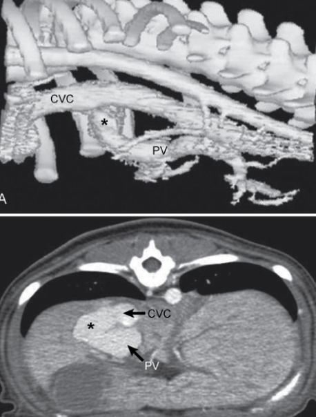 <p>- AUS (User dependent, but can allow visualization of concurrent urinary abnormalities)</p><p>- Scintigraphy</p><p><strong>- CT angiography (gold standard for humans (and at OSU), non-invasive, fast, imaging of all portal tributaries)</strong></p><p>- Portovenography</p><p>- MRI (uncommon)</p>