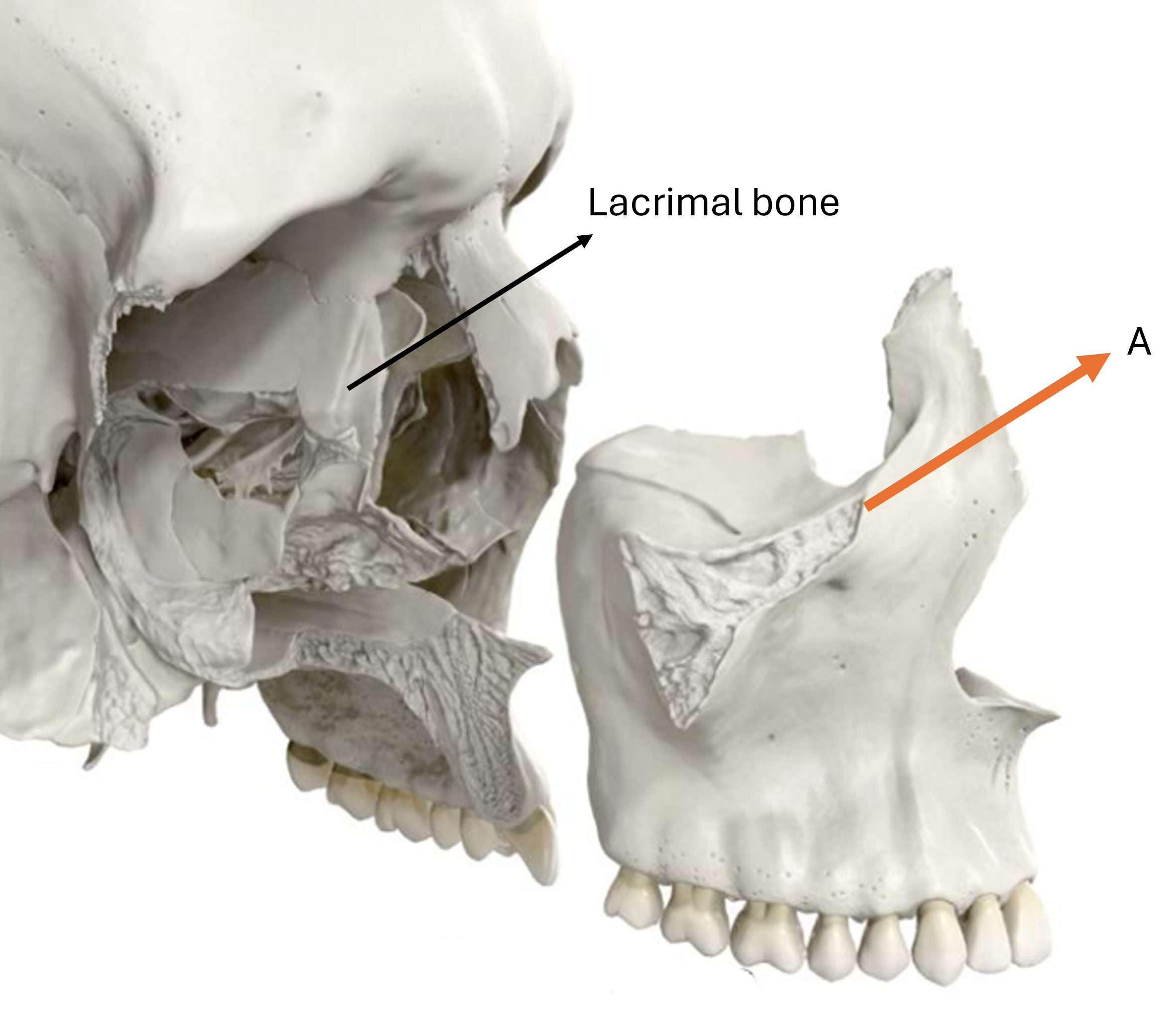term image