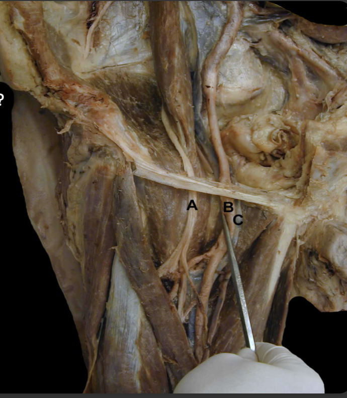 <p>What are the borders of the Femoral Triangle?&nbsp;</p>