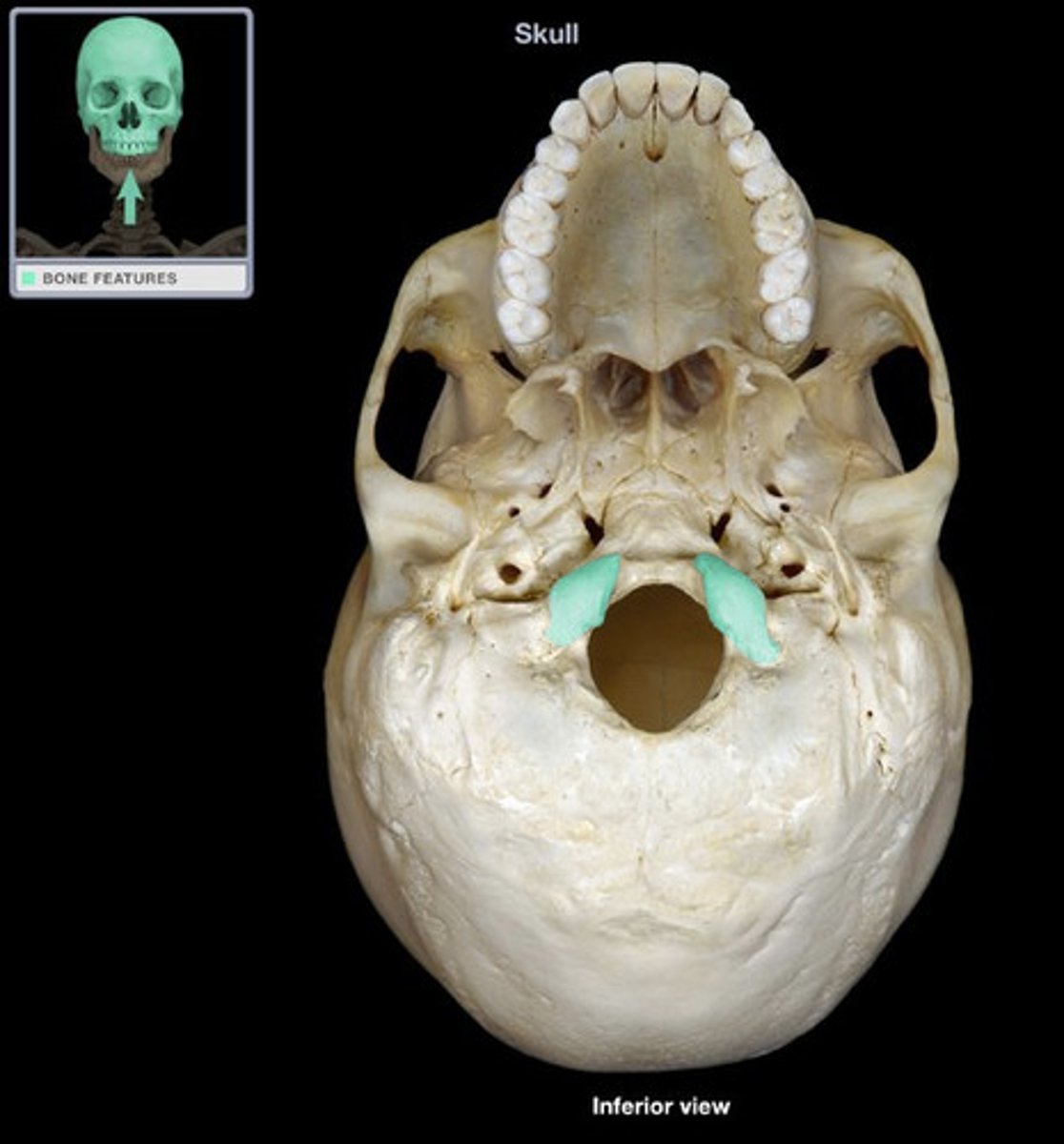 <p>occipital bone</p>