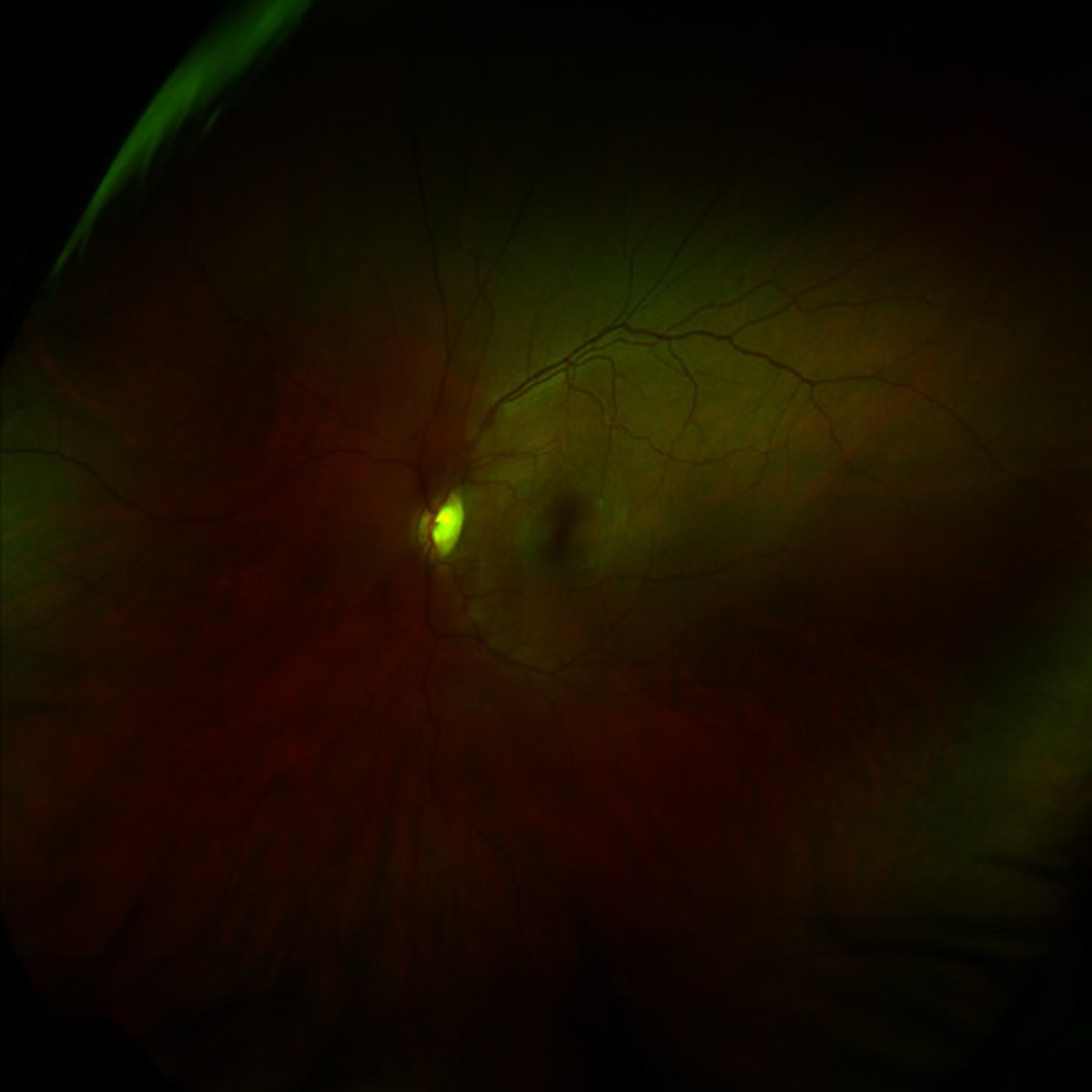 <p>the light-sensitive inner lining of the back of the eyeball; contains receptor cells</p>