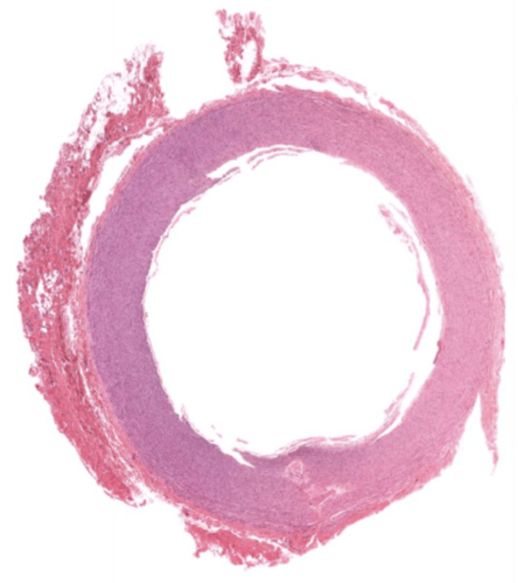 <p>A blood vessel that carries blood away from the heart</p>