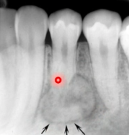 <p>how would you describe the BORDER of this lesion</p>