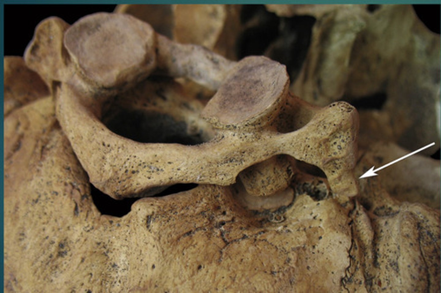 <p>What anomaly is this?</p>