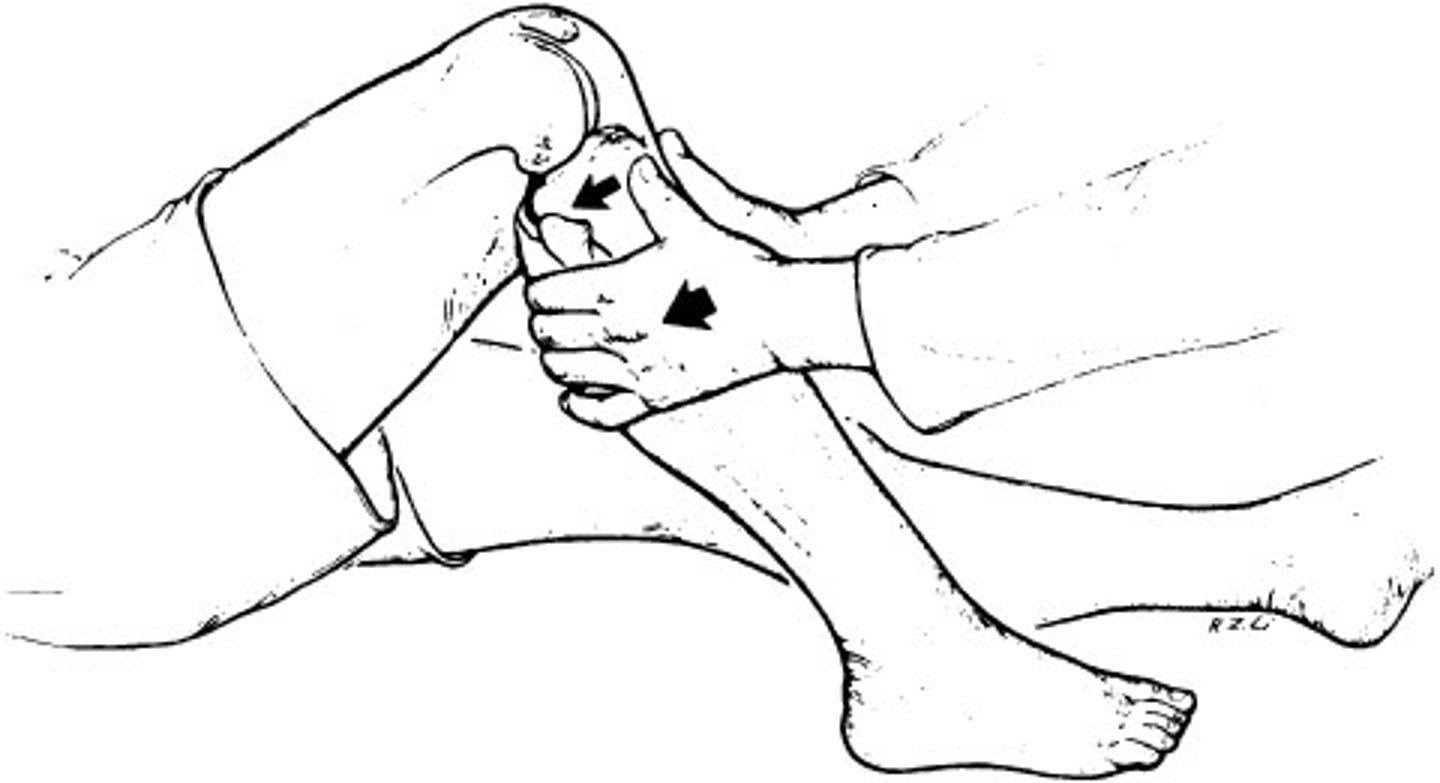 <p>Posterior cruciate ligament integrity</p>